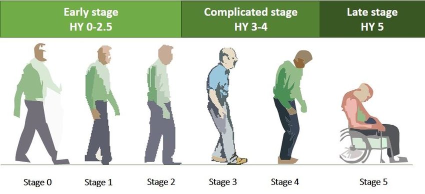 Understanding The Five Stages Of Parkinsons Parkinsons Nsw