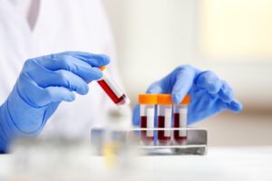 Woman working with blood samples in laboratory, closeup