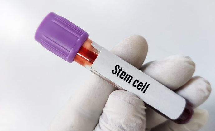 Stem cell