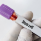 Stem cell