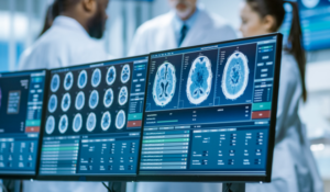 Brain images