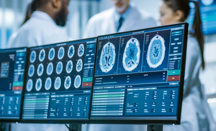 Brain images