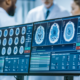 Brain images