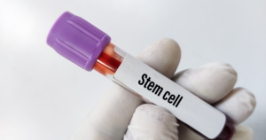 Stem cell