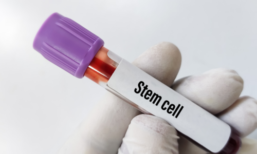 Stem cell