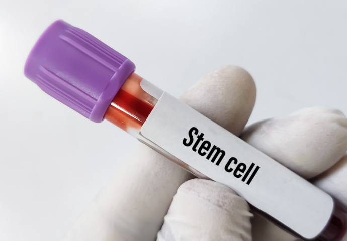 Stem cell