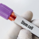 Stem cell