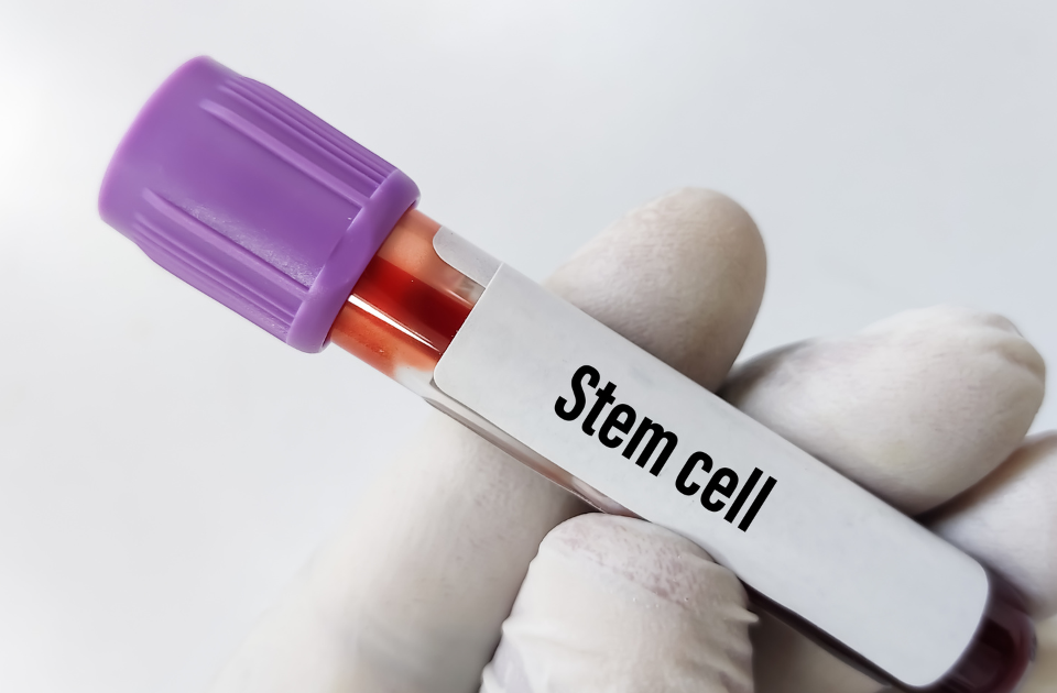 Stem cell